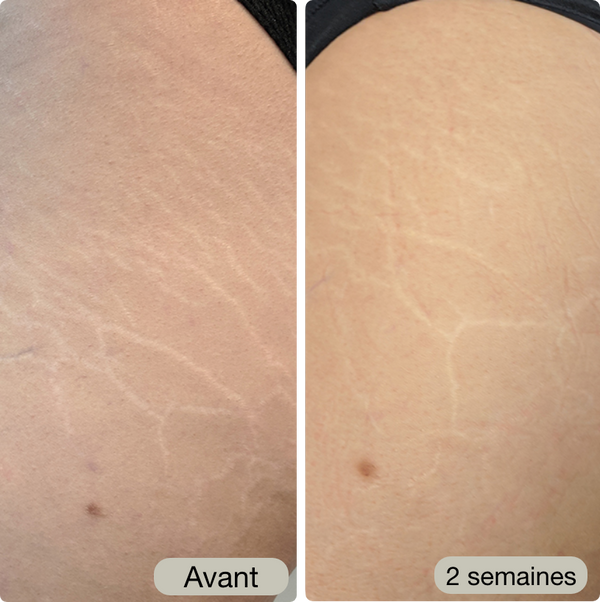 Avant / Après de Claire G.