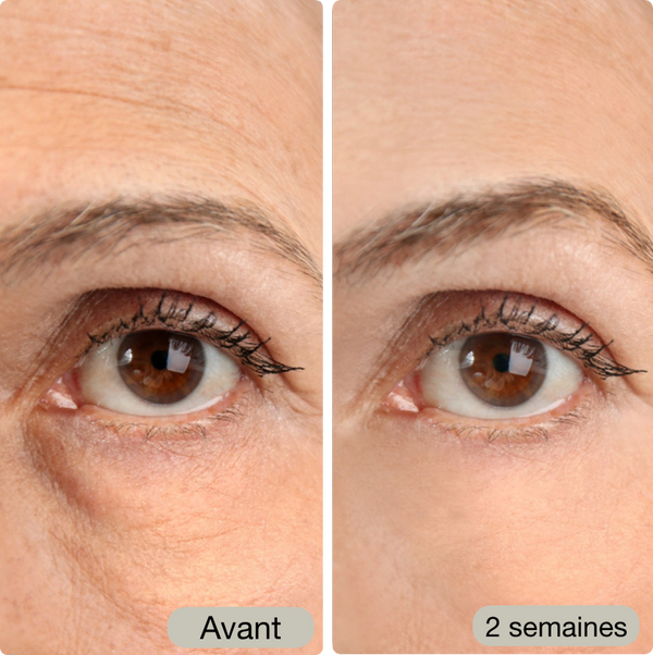 Avant / Après de Angela N.