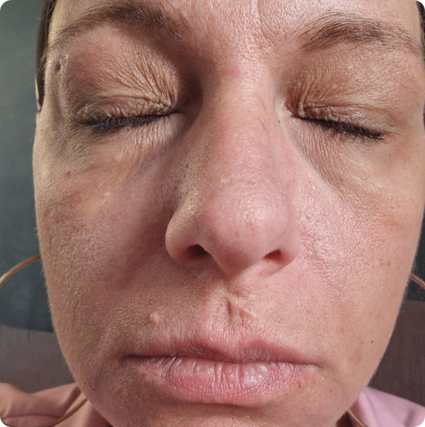 Avant de Laurène P.