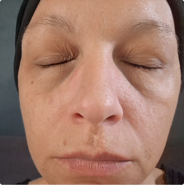 Après de Laurène P.