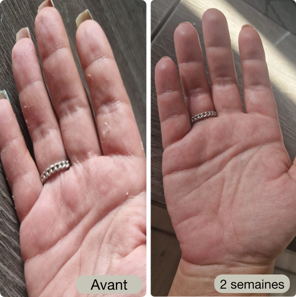 Avant / Après de Noémie O.