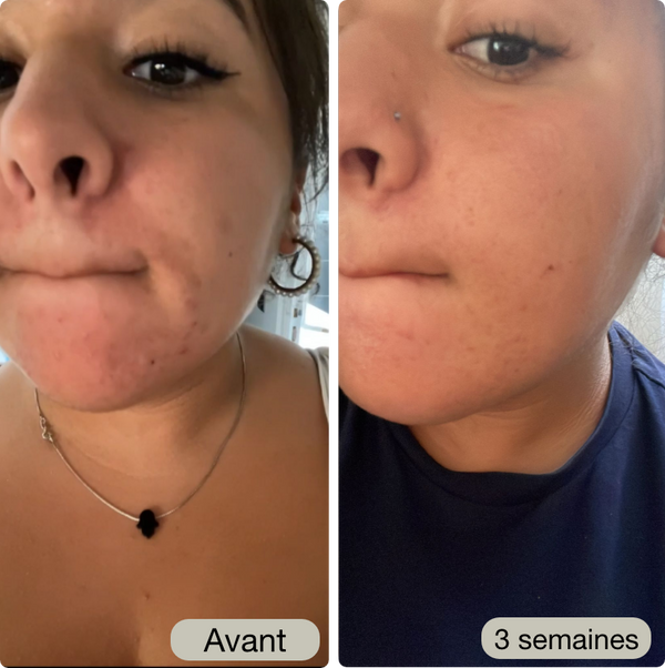 Avant / Après de Sophia H