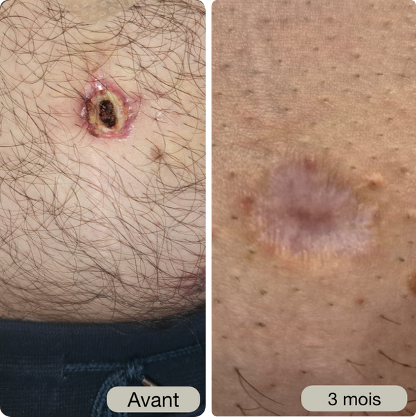 Avant / Après de Sébastien P.