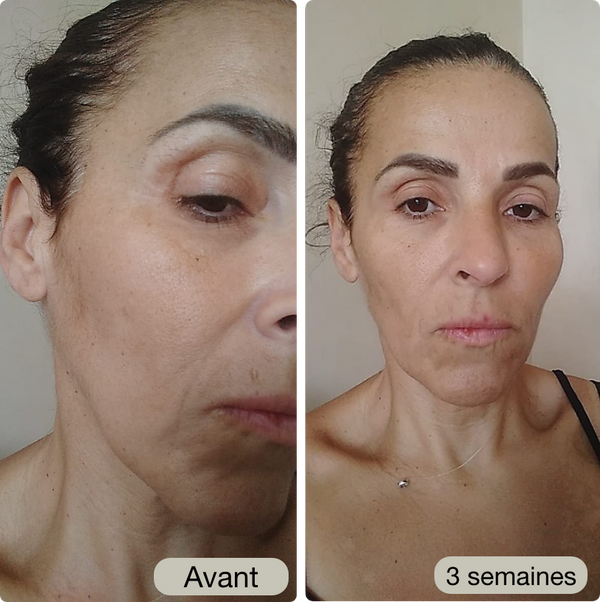 Avant / Après de Karima B.