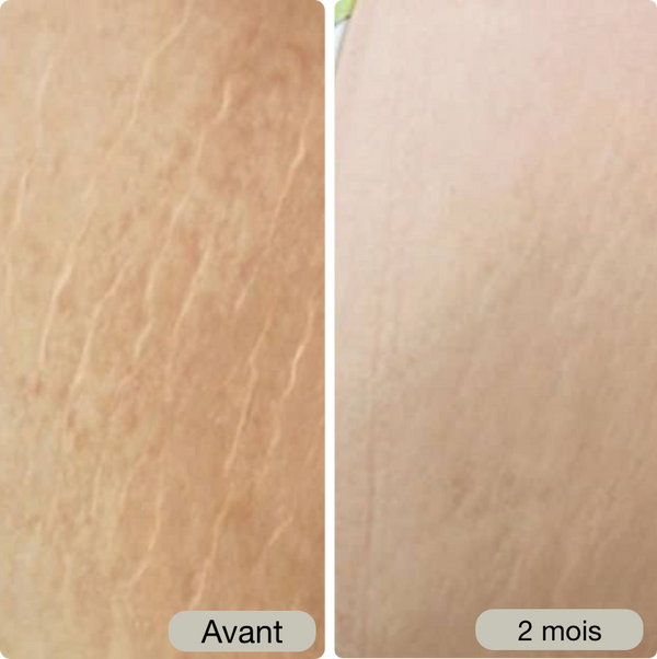 Avant / Après de Claire G.